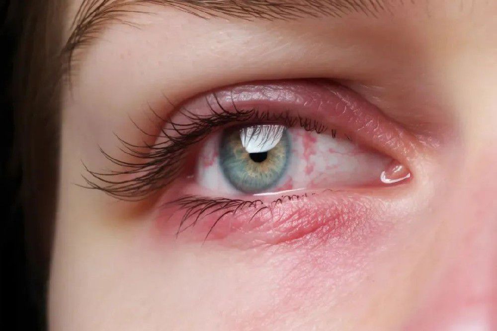 警惕 | 你的化妆包可能藏着"眼睛杀手"!这些细节你注意到了吗?